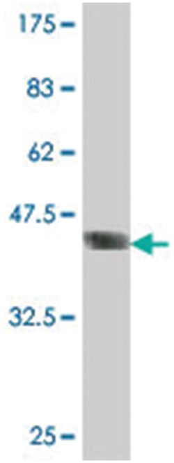 MDFI, Mouse, Polyclonal Antibody, Abnova 50&mu;L; Unlabeled:Antibodies,