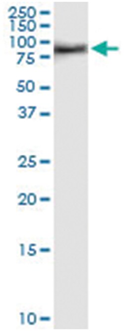 anti-MDM4, Human, IP-WB Antibody Pair, Abnova™