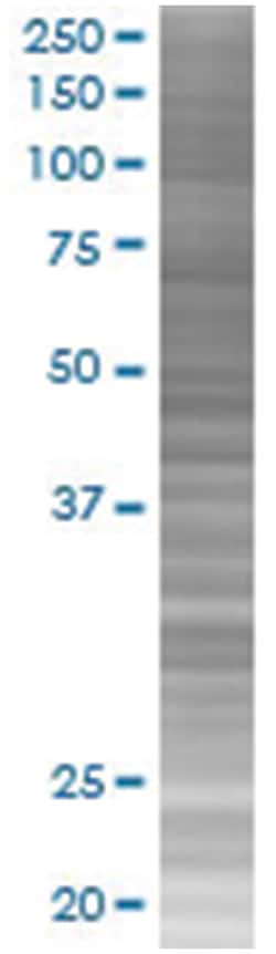 MEN1 293T Cell Overexpression Lysate (Denatured), Abnova 100 &mu;L | Buy Online | Abnova | Fisher Scientific