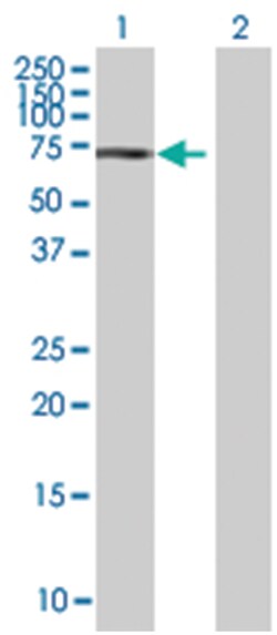 MEN1 293T Cell Overexpression Lysate (Denatured), Abnova