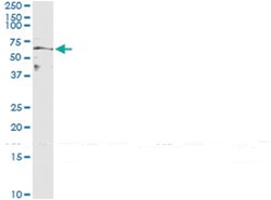 MFGE8, Human, IP-WB Antibody Pair (PW2), Abnova™