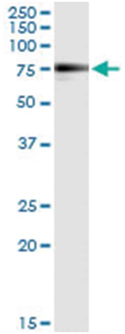 Abnova anti-MGAT3, Human, IP-WB Antibody Pair, Abnova™