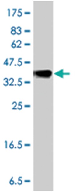 MGAT5, Mouse, Polyclonal Antibody, Abnova 50 &mu;L | Buy Online | Abnova Corporation | Fisher Scientific