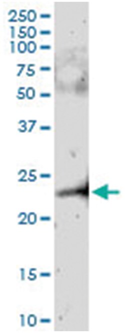 anti-MGMT, Human, IP-WB Antibody Pair, Abnova&trade;