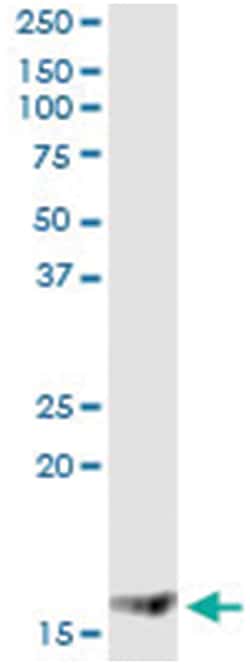 MGST2, Human, IP-WB Antibody Pair (PW1), Abnova™
