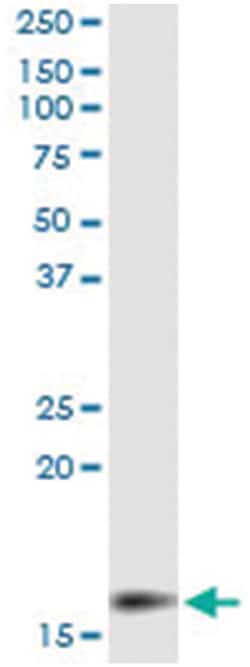 MGST2, Human, IP-WB Antibody Pair (PW2), Abnova&trade;