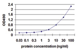 anti-MIF Matched Antibody Pair, Abnova