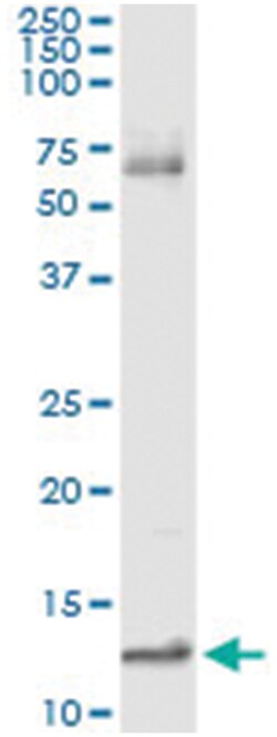 anti-MIF, Human, IP-WB Antibody Pair, Abnova&trade;