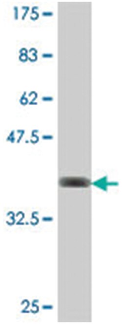 MKLN1, Mouse, Polyclonal Antibody, Abnova 50&mu;L; Unlabeled:Antibodies,
