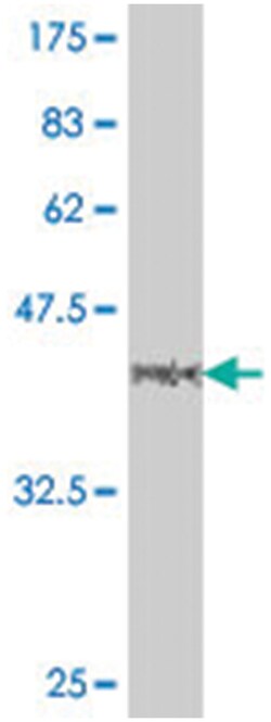 MLL, Mouse, Polyclonal Antibody, Abnova 50 &mu;L | Buy Online | Abnova Corporation | Fisher Scientific