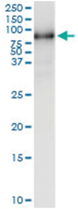 anti-MMP1, Human, IP-WB Antibody Pair, Abnova 1 Set:Antibodies, Monoclonal/Polyclonal