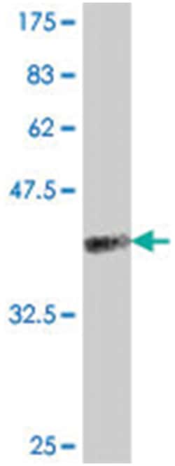 MMP7, Mouse, Polyclonal Antibody, Abnova 50&mu;L; Unlabeled:Antibodies,
