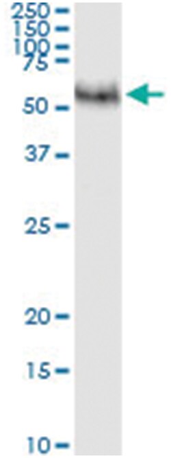 anti-MMP8, Human, IP-WB Antibody Pair, Abnova 1 Set:Antibodies, Monoclonal/Polyclonal