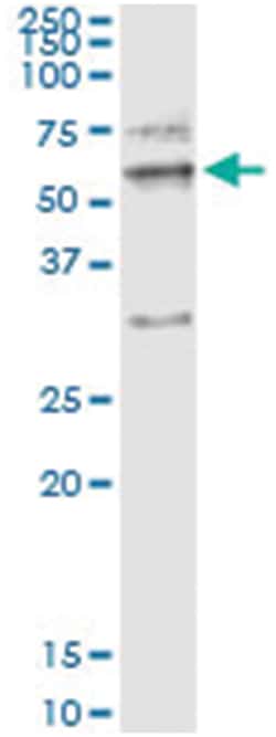 anti-MMP12, Human, IP-WB Antibody Pair, Abnova&trade;