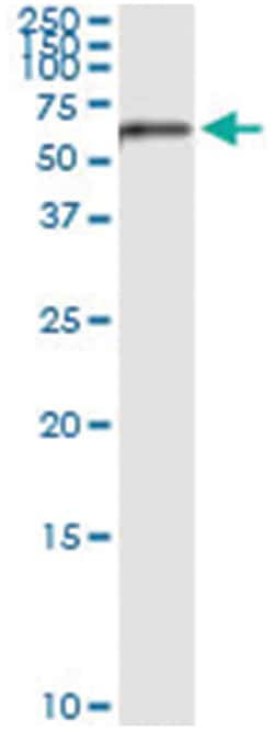 MMP13, Human, IP-WB Antibody Pair (PW1), Abnova 1 Set:Antibodies, Monoclonal/Polyclonal