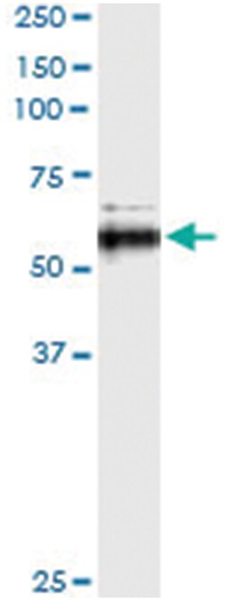 MMP13, Human, IP-WB Antibody Pair (PW2), Abnova&trade;