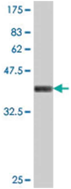 MPP1 (A02), Mouse anti-Human, Polyclonal Antibody, Abnova 50&mu;L; Unlabeled:Antibodies,
