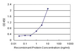 anti-MPP1 Matched Antibody Pair, Abnova