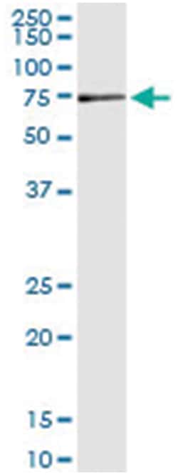 MPP2, Human, IP-WB Antibody Pair (PW2), Abnova&trade;