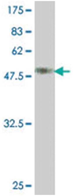 MPZ, Mouse, Polyclonal Antibody, Abnova 50&mu;L; Unlabeled:Anticuerpos