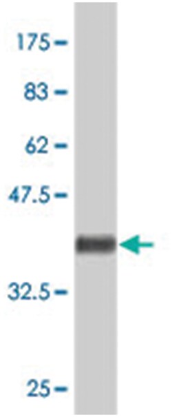 MRC1, Mouse, Polyclonal Antibody, Abnova 50&mu;L; Unlabeled:Antibodies,