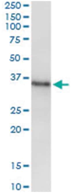 MSX1, Human, IP-WB Antibody Pair (PW3), Abnova 1 Set:Antibodies, Monoclonal/Polyclonal