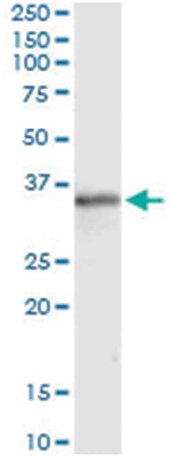 MSX1, Human, IP-WB Antibody Pair (PW5), Abnova 1 Set:Antibodies, Monoclonal/Polyclonal