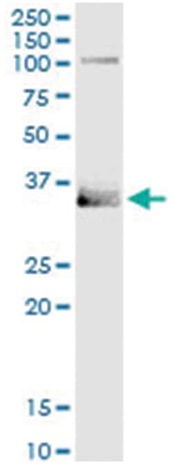 MSX1, Human, IP-WB Antibody Pair (PW6), Abnova™