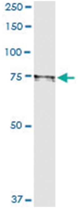 anti-MTHFR, Human, IP-WB Antibody Pair, Abnova™