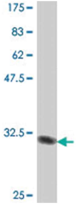 MTNR1A, Mouse, Polyclonal Antibody, Abnova 50&mu;L; Unlabeled:Antibodies,