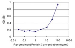 anti-MVD Matched Antibody Pair, Abnova