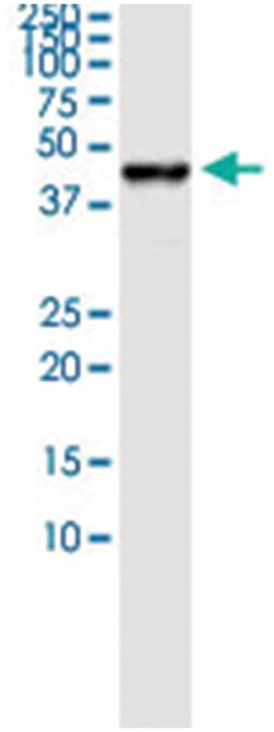 MVD, Human, IP-WB Antibody Pair (PW2), Abnova&trade;