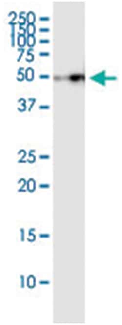 anti-MVK, Human, IP-WB Antibody Pair, Abnova™