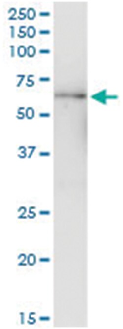 anti-MYC, Human, IP-WB Antibody Pair, Abnova 1 Set:Antibodies, Monoclonal/Polyclonal