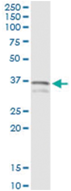 anti-MYD88, Human, IP-WB Antibody Pair, Abnova&trade;