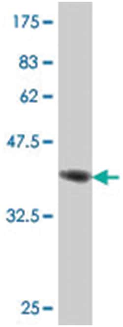 MYL6, Mouse, Polyclonal Antibody, Abnova 50&mu;L; Unlabeled:Antibodies,