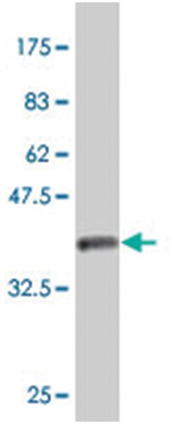 MYO7A, Mouse, Polyclonal Antibody, Abnova 50&mu;L; Unlabeled:Antibodies,