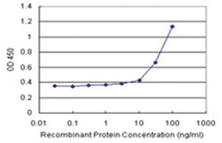 anti-MYOC Matched Antibody Pair, Abnova 1 Set:Antibodies, Monoclonal/Polyclonal