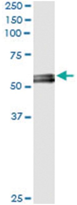 anti-MYOC, Human, IP-WB Antibody Pair, Abnova 1 Set:Antibodies, Monoclonal/Polyclonal