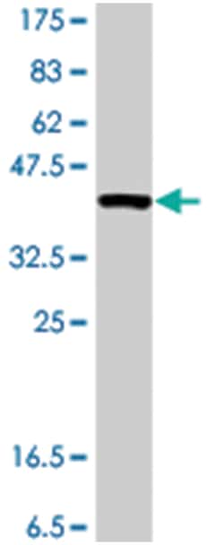 myelin transcription factor 1, Mouse, Polyclonal Antibody, Abnova 50&mu;L;