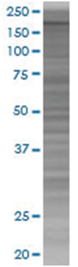MYT1 293T Cell Overexpression Lysate (Denatured), Abnova 100 &mu;l | Buy Online | Abnova | Fisher Scientific