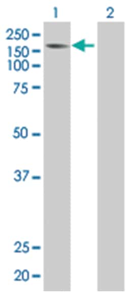 MYT1 293T Cell Overexpression Lysate (Denatured), Abnova 100 &mu;l | Buy Online | Abnova | Fisher Scientific