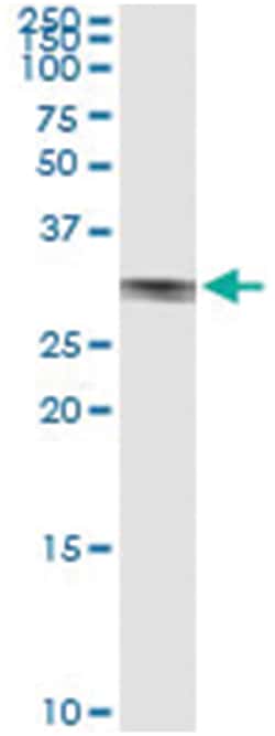anti-NAB2, Human, IP-WB Antibody Pair, Abnova™
