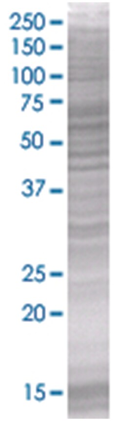NAP1L1 293T Cell Overexpression Lysate 1 (Denatured), Abnova 100 &mu;L | Buy Online | Abnova | Fisher Scientific