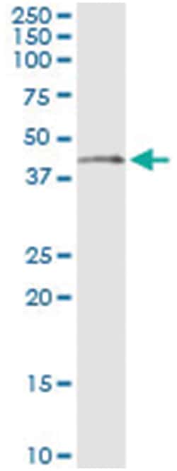 NDN, Human, IP-WB Antibody Pair (PW2), Abnova&trade;