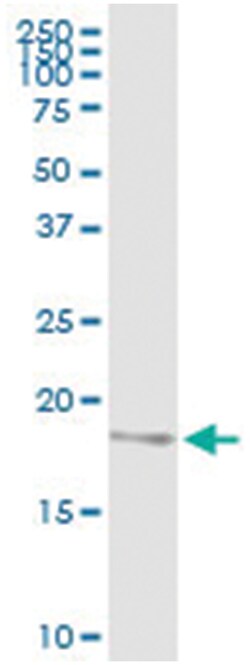 anti-NDUFB6, Human, IP-WB Antibody Pair, Abnova 1 Set:Antibodies, Monoclonal/Polyclonal