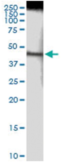 anti-NDUFS2, Human, IP-WB Antibody Pair, Abnova™