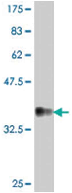NDUFV1, Mouse, Polyclonal Antibody, Abnova 50&mu;L; Unlabeled:Antibodies,