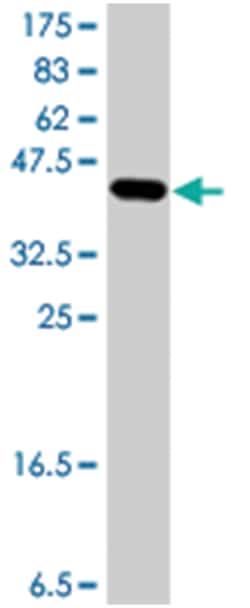 NDUFV3, Mouse, Polyclonal Antibody, Abnova 50&mu;L; Unlabeled:Antibodies,