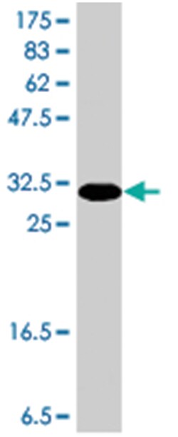 NELL1, Mouse, Polyclonal Antibody, Abnova 50&mu;L; Unlabeled:Antibodies,